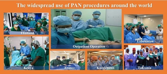 PAN